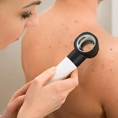 Dermatologische Untersuchung